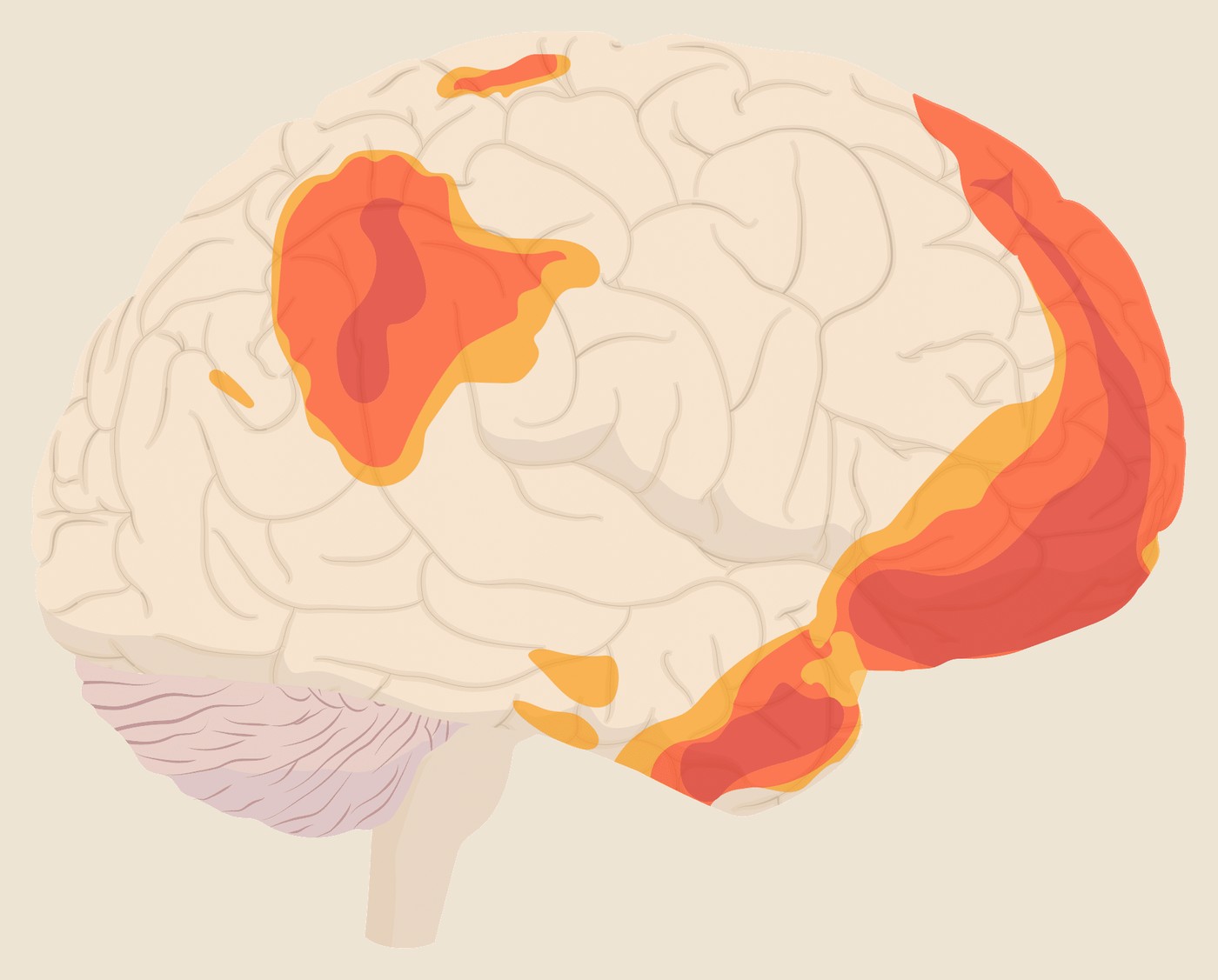 Illustration af hjernen med Default Mode Network markeret